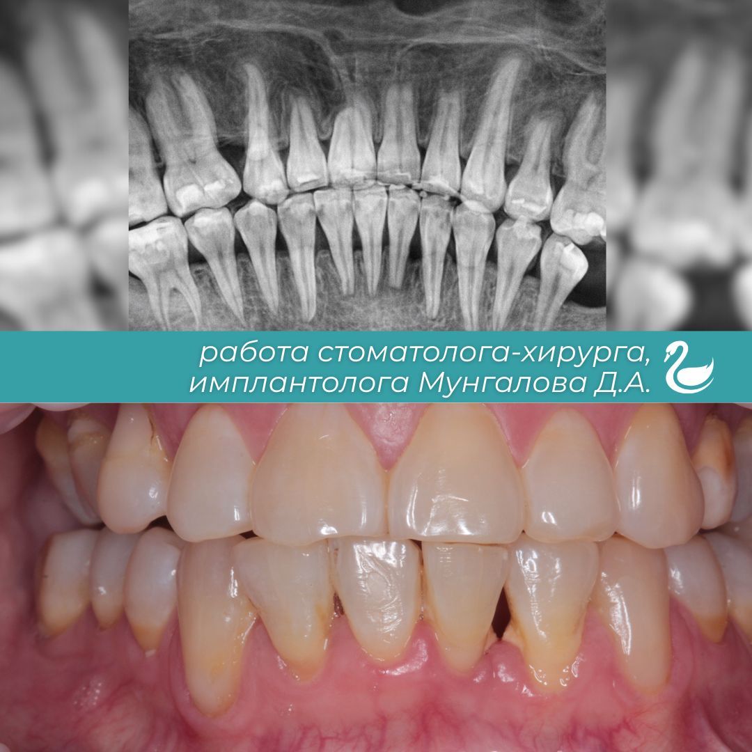 Blue Professional Dentist Book Now Instagram Post (17).jpg