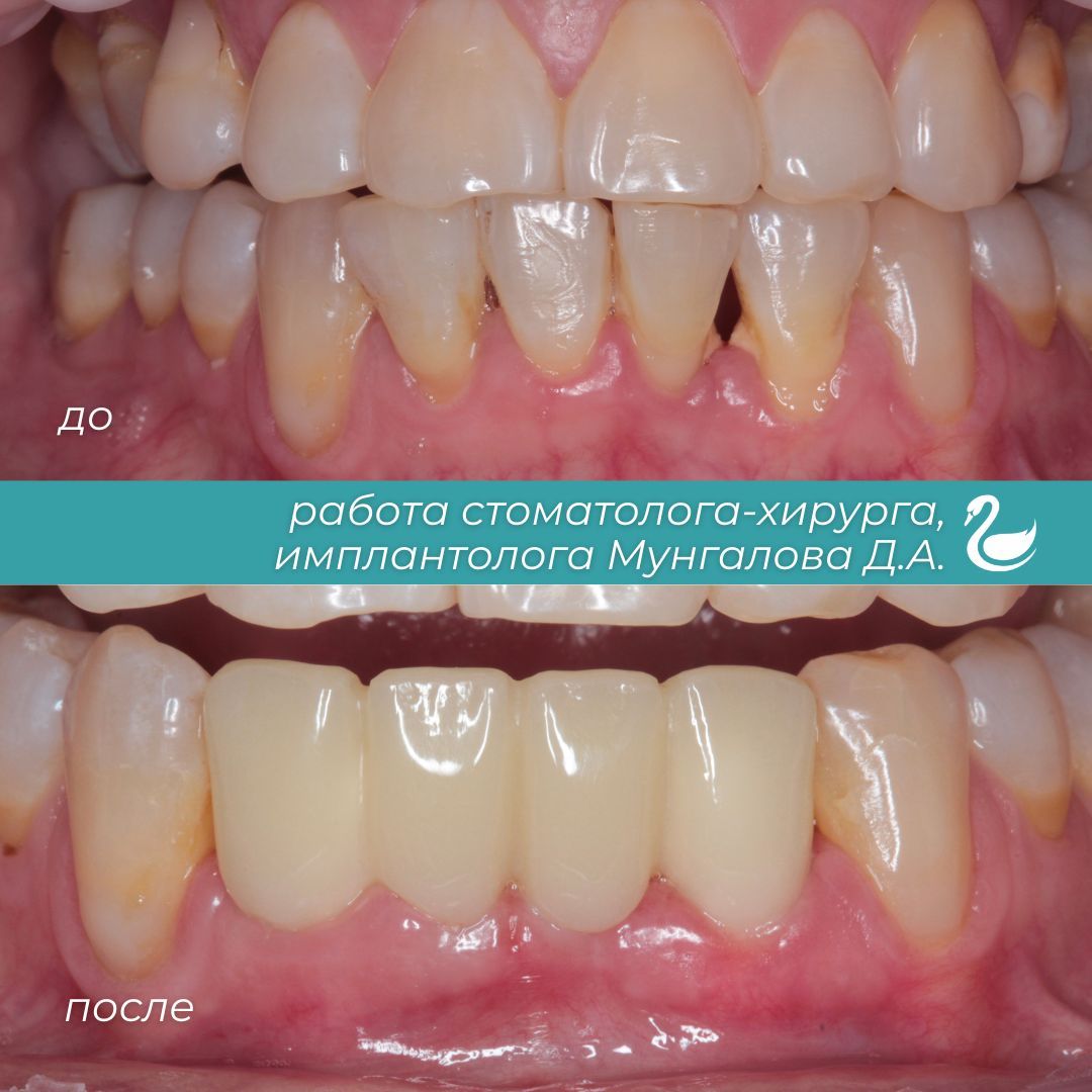 Blue Professional Dentist Book Now Instagram Post (19).jpg