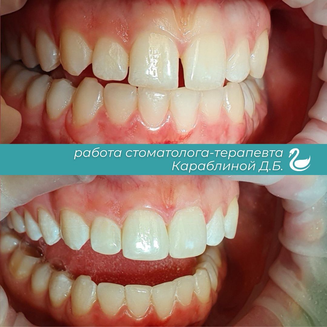 Blue Professional Dentist Book Now Instagram Post (2).jpg